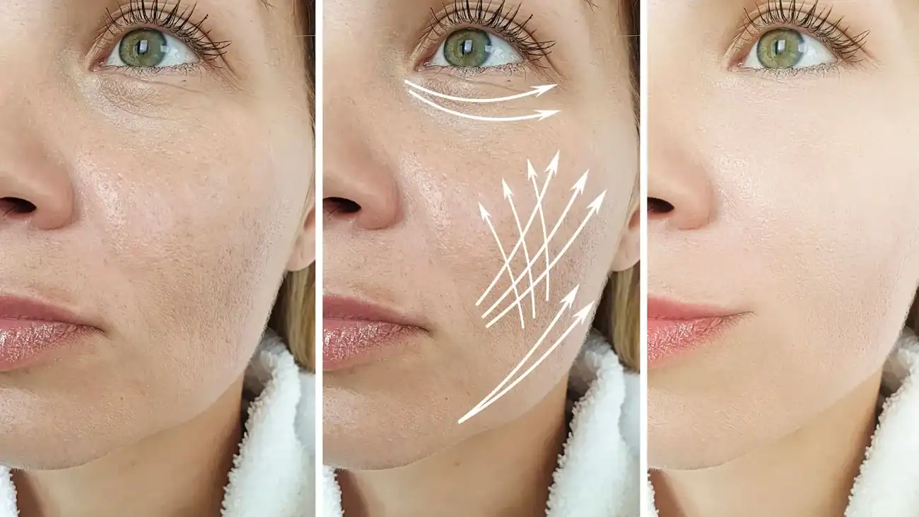 Can One Treatment Really Tackle More Than One Skin Concern Oxted?