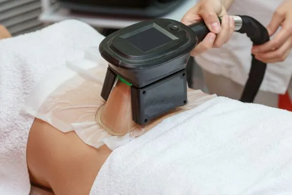 Image of person having fat freezing treatment to help weight gain Oxted