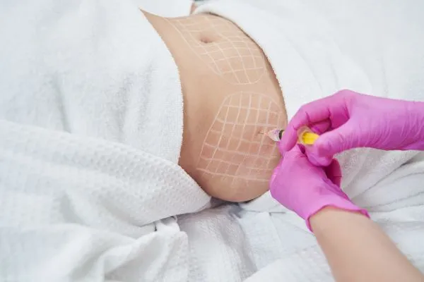image of fat dissolving injections on love handles to help combat weight gain Oxted