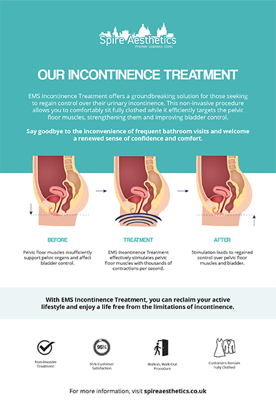image to show how EMS treatment works for female urinary incontinence Oxted