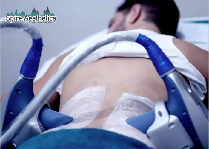Man having fat freezing treatment done on love handles before a competitions Oxted to create a sculpted look.