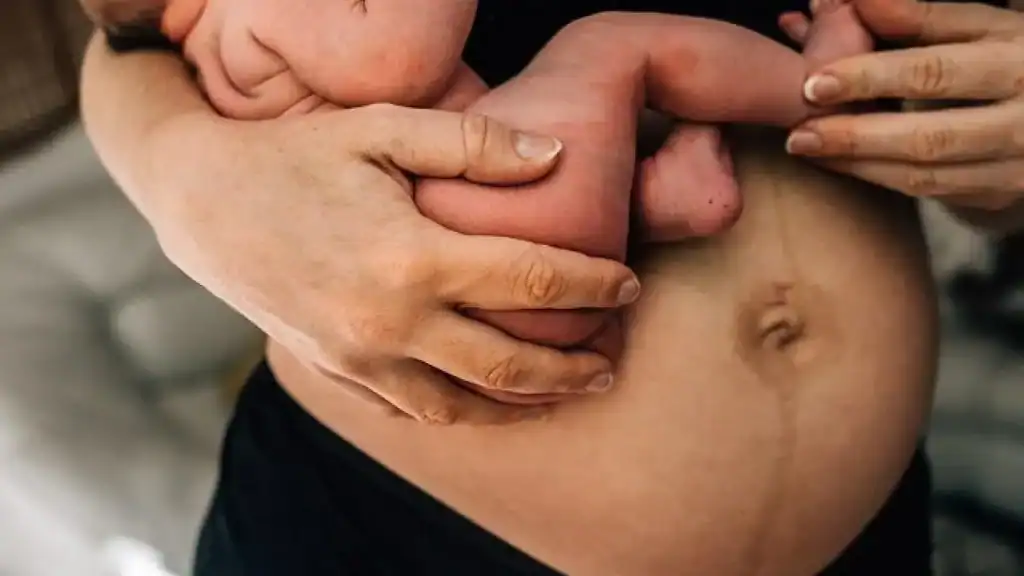 Why Is My Stomach Still Big After Pregnancy Oxted?