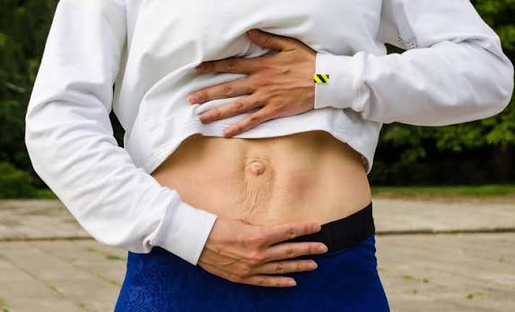 When Could Diastasis Recti Be the Missing Piece of the Puzzle Oxted?